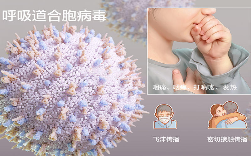 发热、鼻塞纷歧定是新冠，，，，小心人呼吸道合胞病毒熏染！